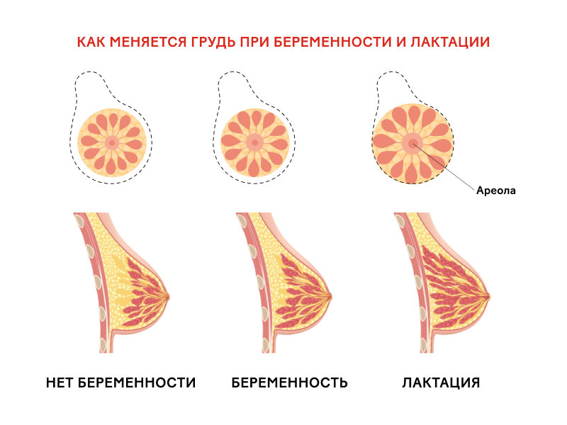 Схематическое представление изменений строения молочной железы при беременности и лактации
