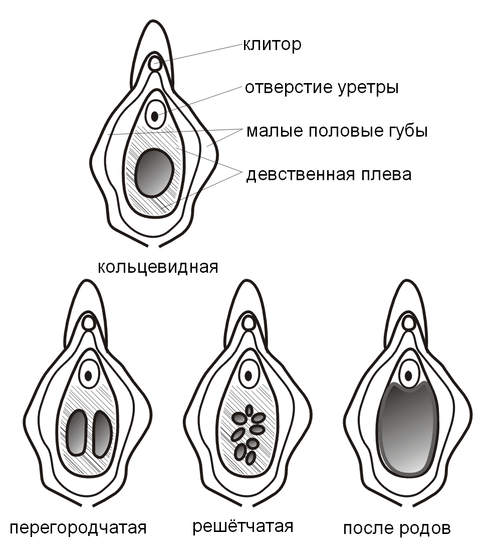 Типы дегтярных плесеней