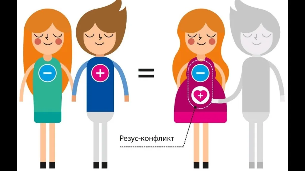 Резус-конфликт при беременности