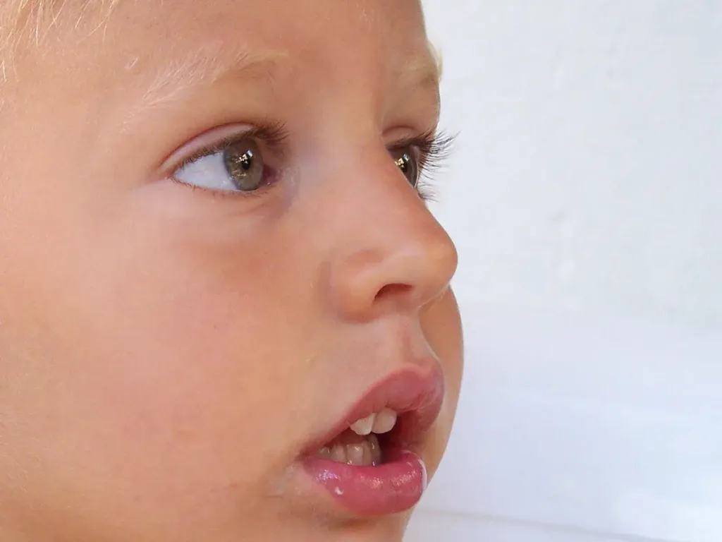 Частые сопли и заложенность у малышей 1-3 лет: сухой воздух, аллергия или аденоиды