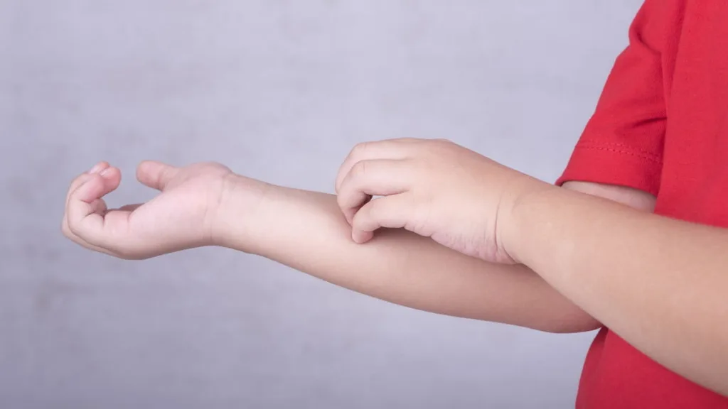 Чесотка у детей 1–3 лет: как выглядит и что делать