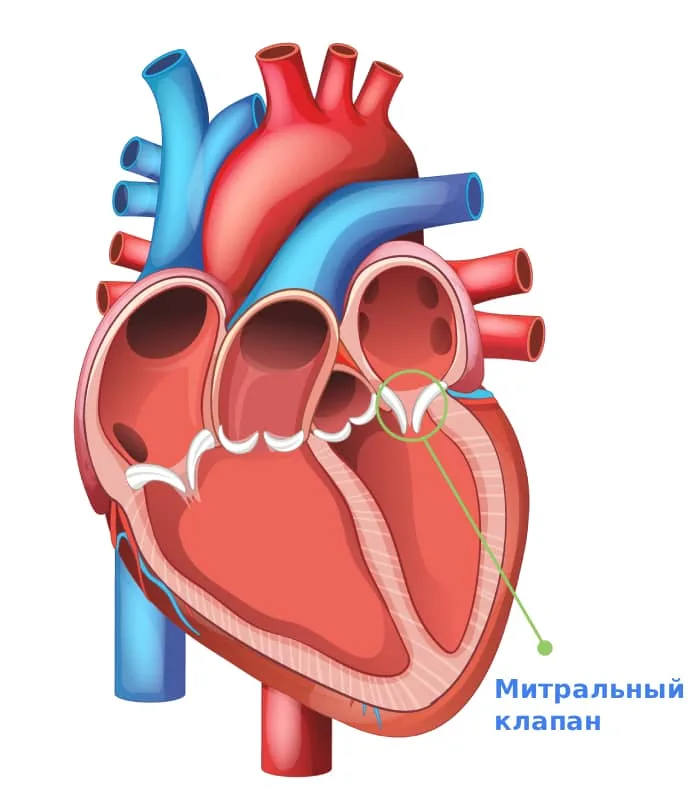 Недостаточность митрального клапана: симптомы и лечение