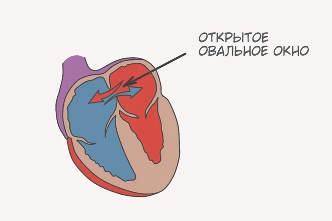 Открытое овальное окно: нужно ли его закрывать